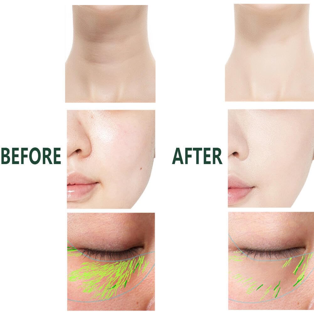 3-in-1 Anti-Wrinkle Face, Neck & Eye Massager